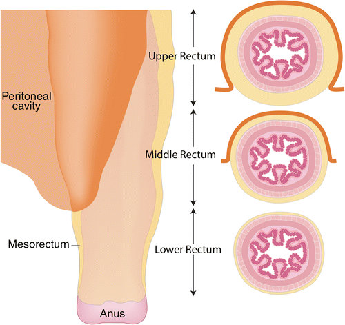 MRI of Rectal Cancer: Tumor Staging, Imaging Techniques, and Management |  RadioGraphics