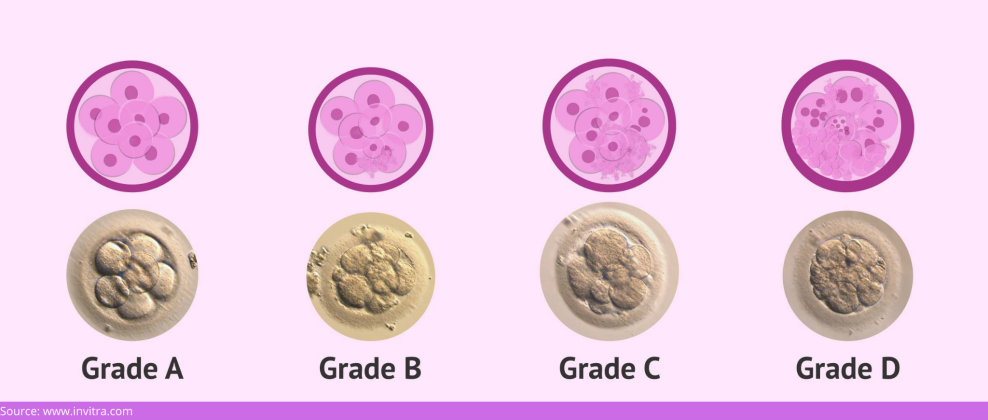 Unraveling the Mystery: Why is the Embryo Not Growing in IVF?