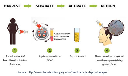 PRP hair therapy