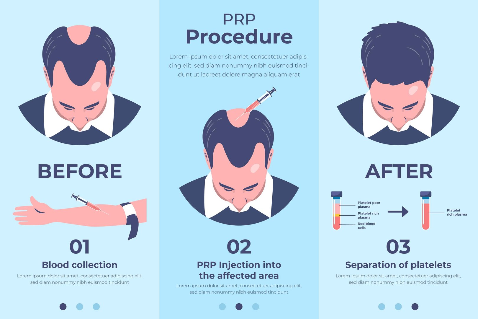 PRP therapy