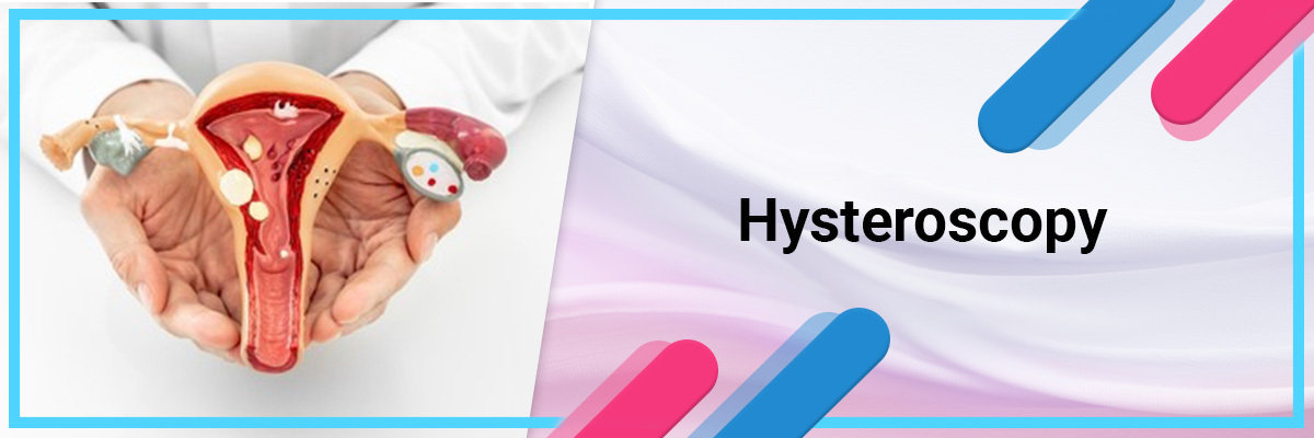 Hysteroscopy – Procedure, advantages, and recovery Hysteroscopy – Procedure, advantages, and recovery