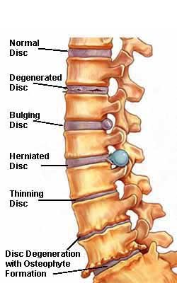 Back Problems | Your Complete Guide to Diagnosing Back Pain