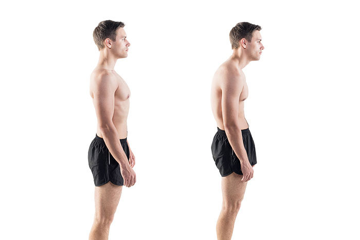 What Is Bad Posture? - Posture Possible