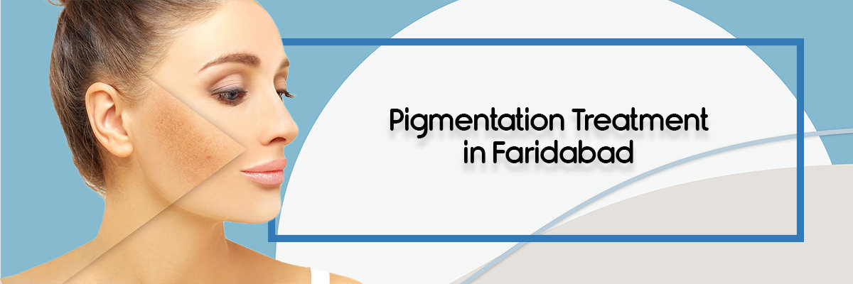 Pigmentation Treatment Pigmentation Treatment