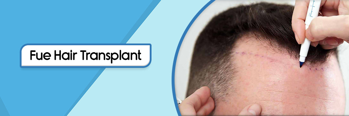 hair transplant clinics in faridabad