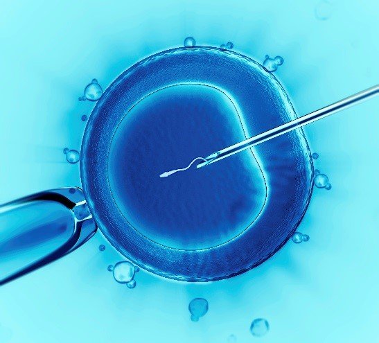 ICSI Key Findings | Assisted Reproductive Technology (ART) | CDC