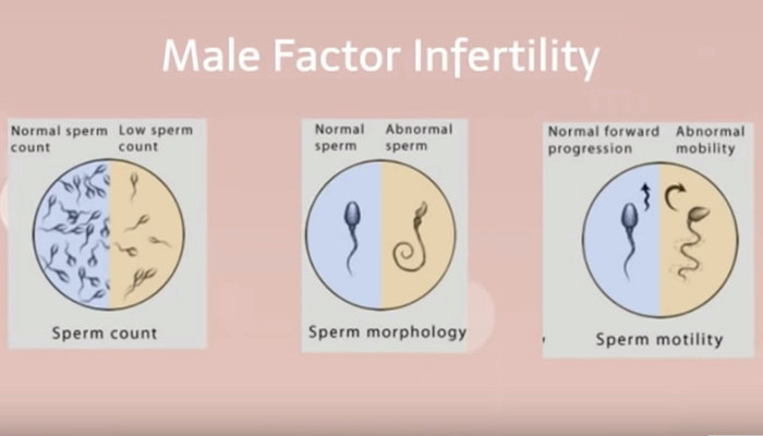 Reasons for infertility