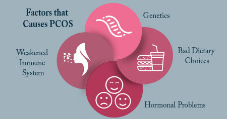 Polycystic Ovarian Syndrome - Causes