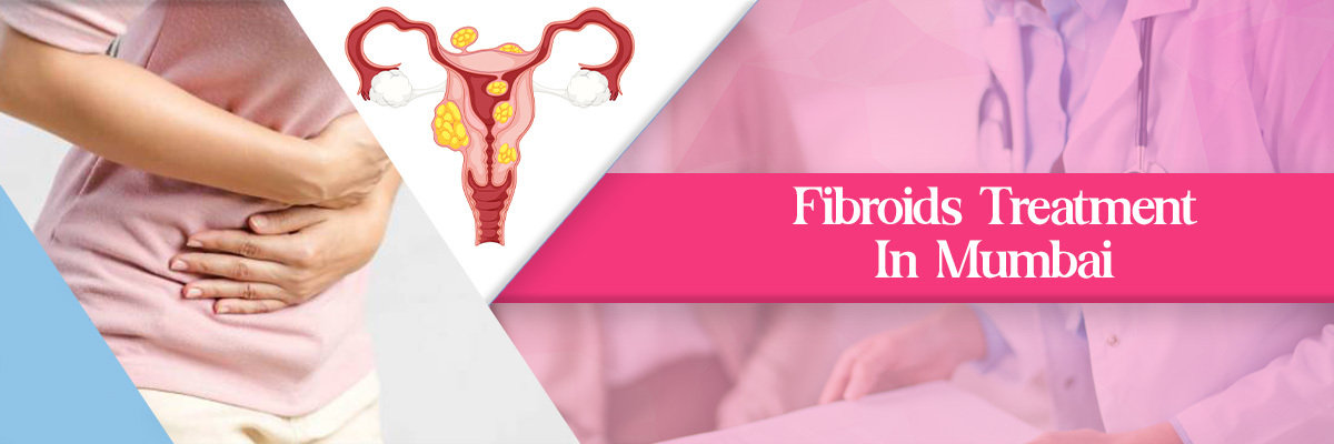 Fibroids Treatment Fibroids Treatment