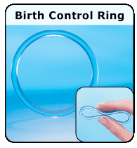 Birth Control Ring (for Teens) - Nemours KidsHealth