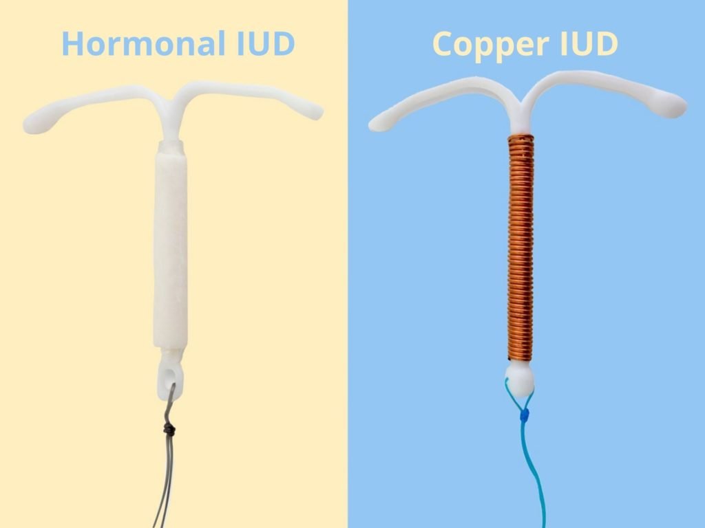 Meet the Intrauterine Device IUD | Aspivix