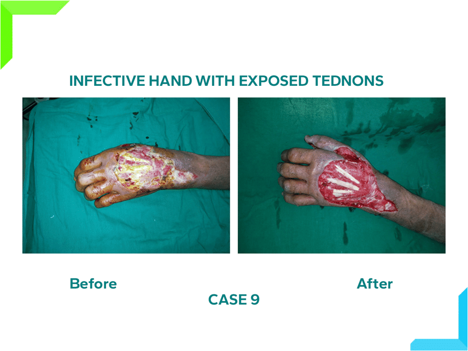 Injective Hand Injective Hand
