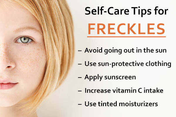 How to Lighten and Fade Freckles: 4 Natural Home Remedies