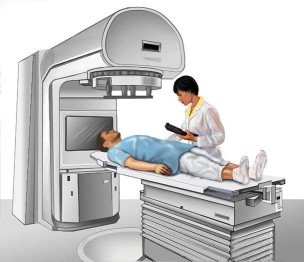 Chemotherapy