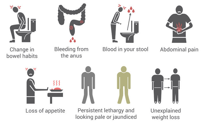 Colorectal Cancer: Causes, Symptoms, Screening & Treatment | Health Plus