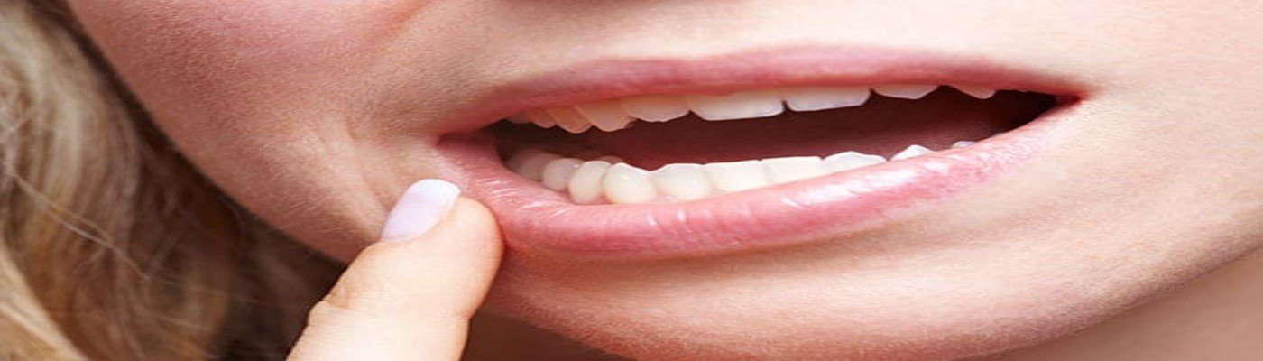 Oral Cancer Oral Cancer