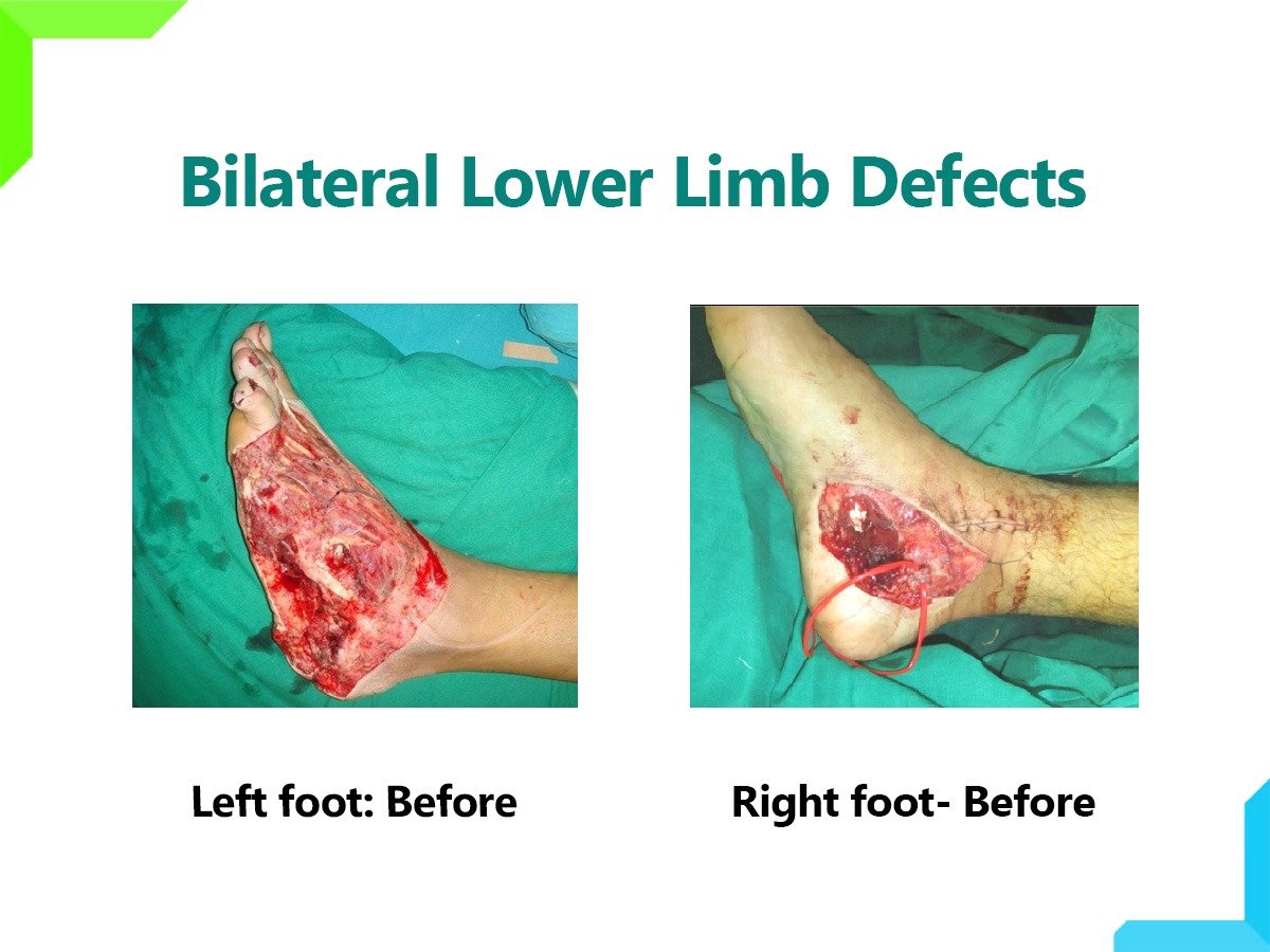lower limb lower limb