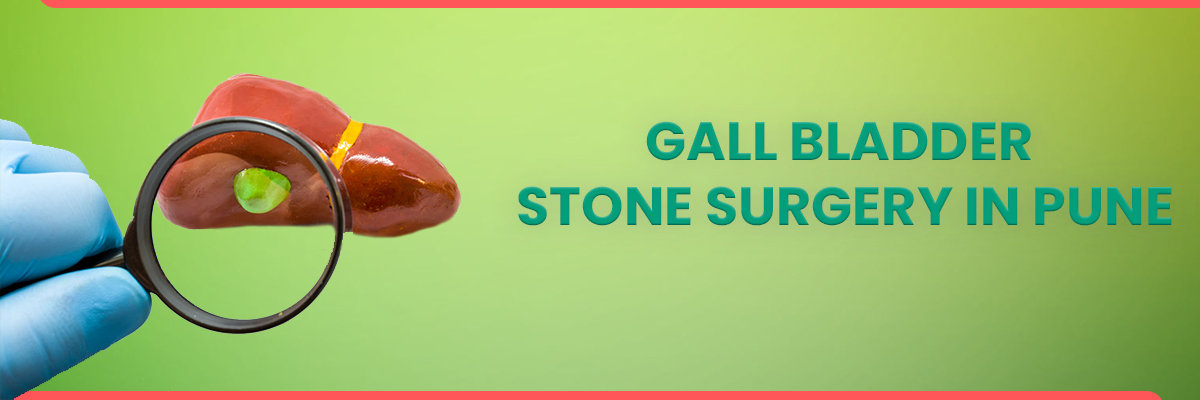gallbladder stone surgery in Pune gallbladder stone surgery in Pune