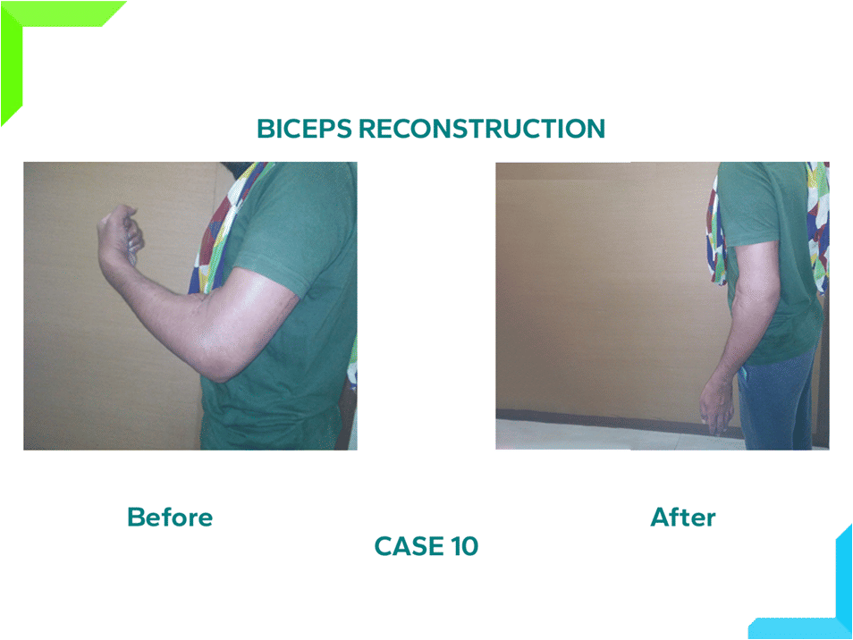 Biceps Construction Biceps Construction