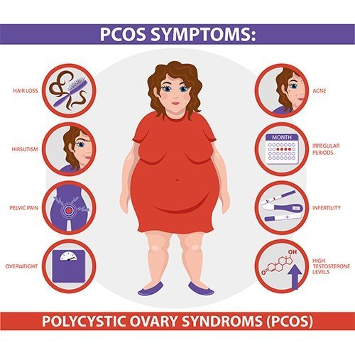 PCOS – Polycystic Ovary Syndrome – What is it? | Dr. Deepa Ganesh