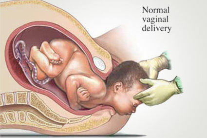 normal delivery