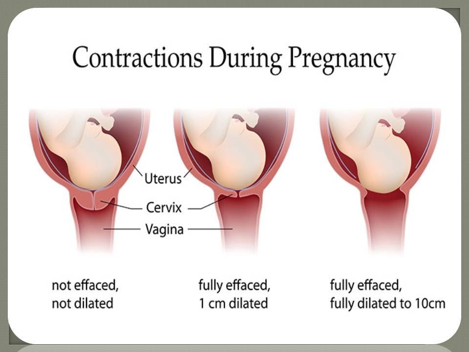 What are Labor Contractions? - Healthreviewguide - Read Review about Health Food, Fitness Tips and Doctor Advice about Good Health