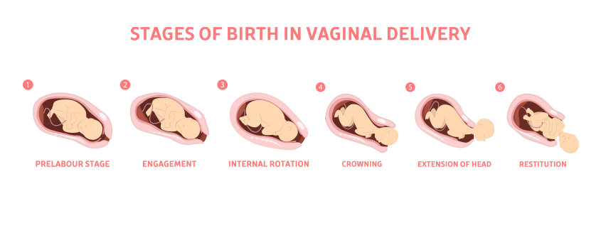 normal-delivery-centre-in-mumbai-budget-fertility-centre