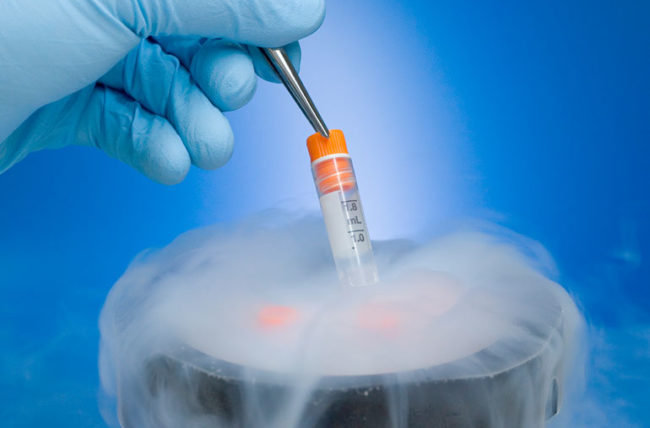 Egg Freezing