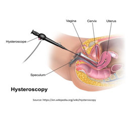 Hysteroscopy