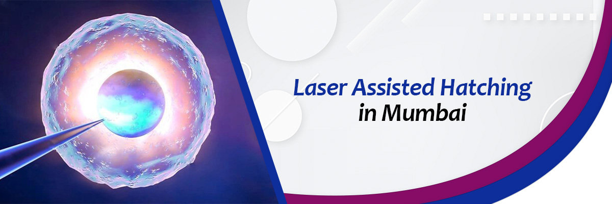 Laser Assisted Hatching Laser Assisted Hatching