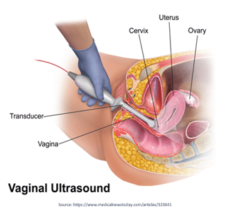 Ultrasound