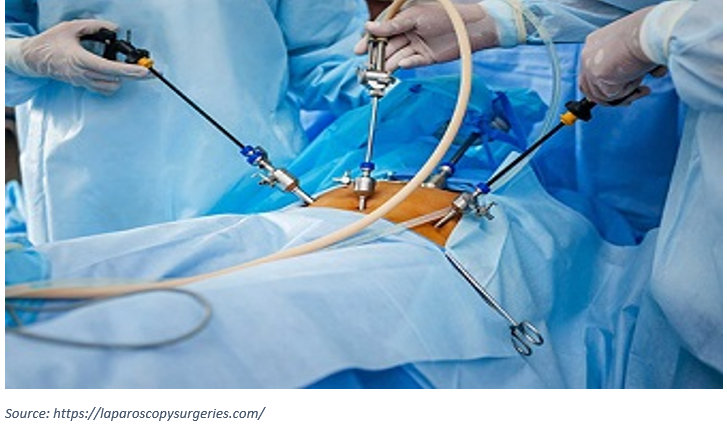 Laparoscopic Myomectomy