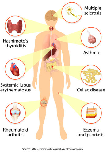 Autoimmune Disorders