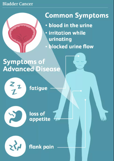 Autoimmune Disorders