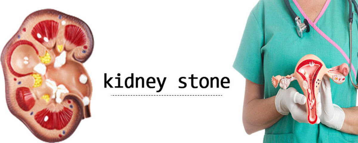 Kidney Stone Treatment