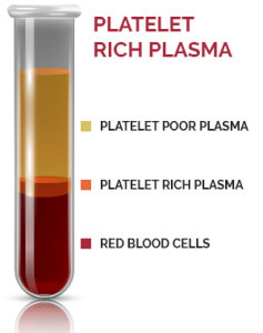 prp