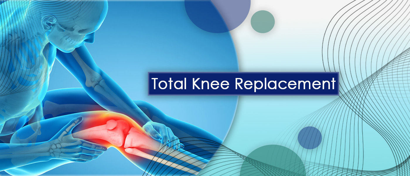 total knee replacement total knee replacement