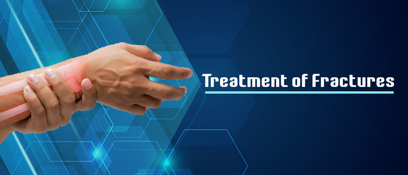 fracture Treatment fracture Treatment