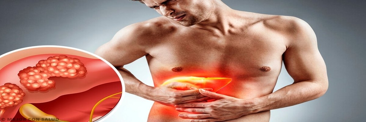Liver Cancer Treatment Liver Cancer Treatment