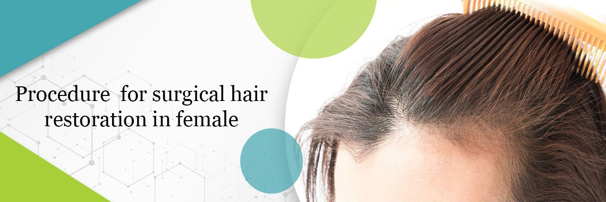 Hair restoration in female
