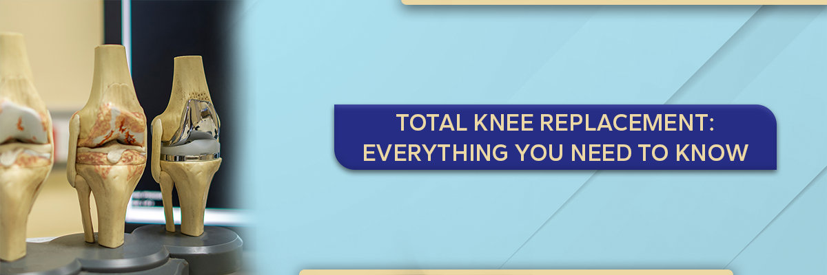 Total Knee Replacement: Everything You Need to Know