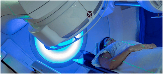 Radiation Therapy in bangalore