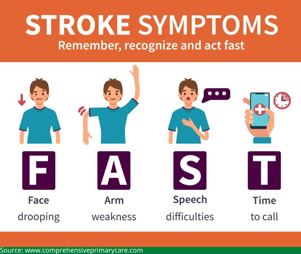 FAST method to detect a stroke