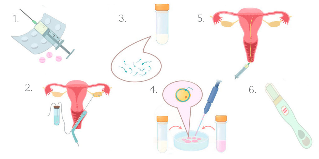 ivf stages