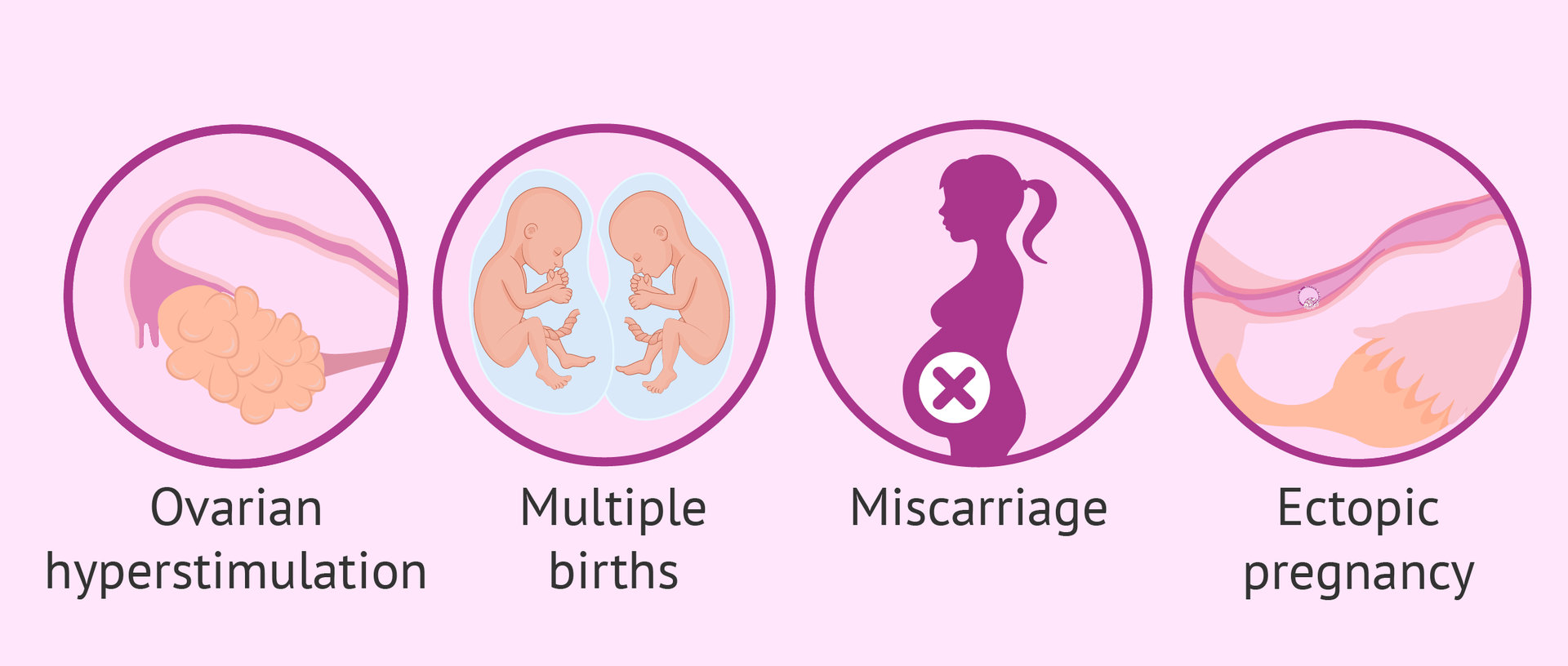  risks and side effects of IVF