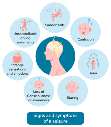 What Are The Do’s And Don’ts Of Seizures | Dr Gurneet