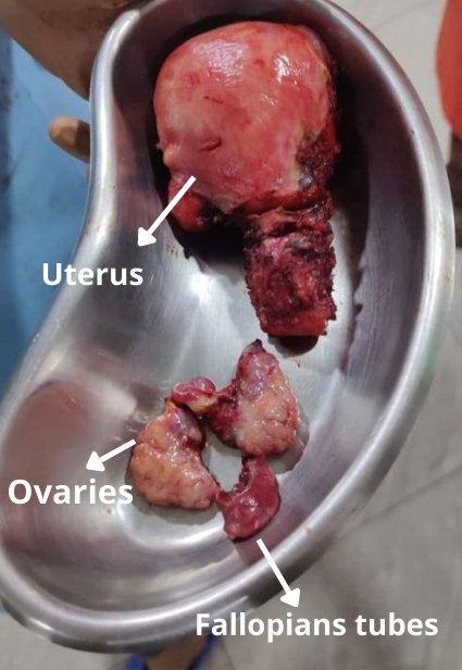 Uterus Uterus