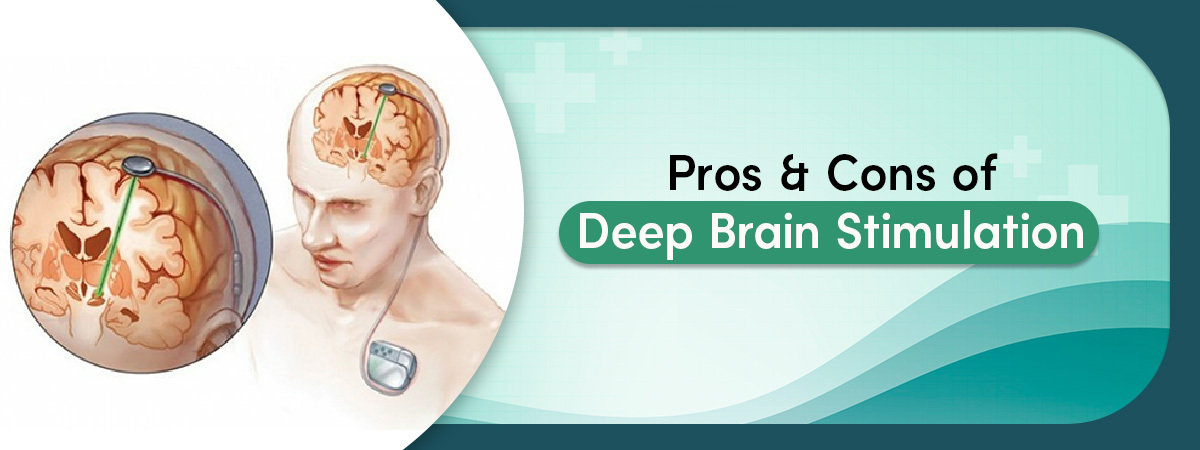 Deep Brain Stimulation surgery in mumbai Deep Brain Stimulation surgery in mumbai