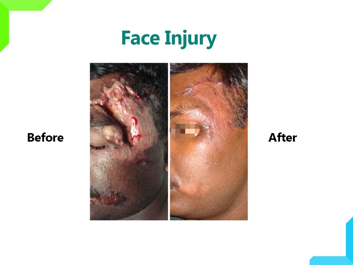 Face Injury Face Injury