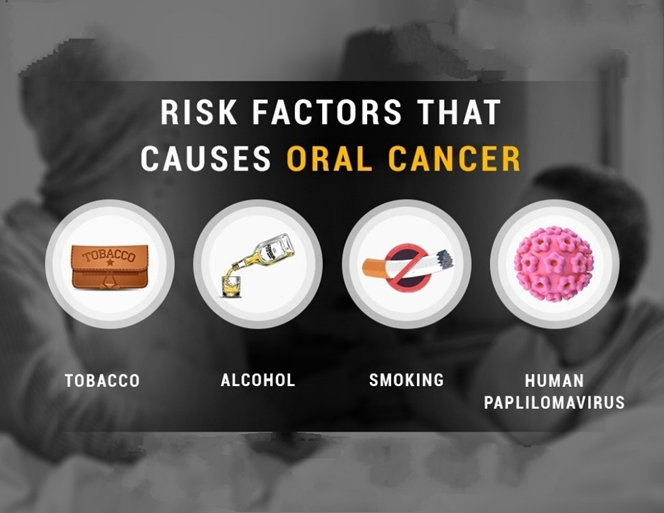 risk factor of oral cancer